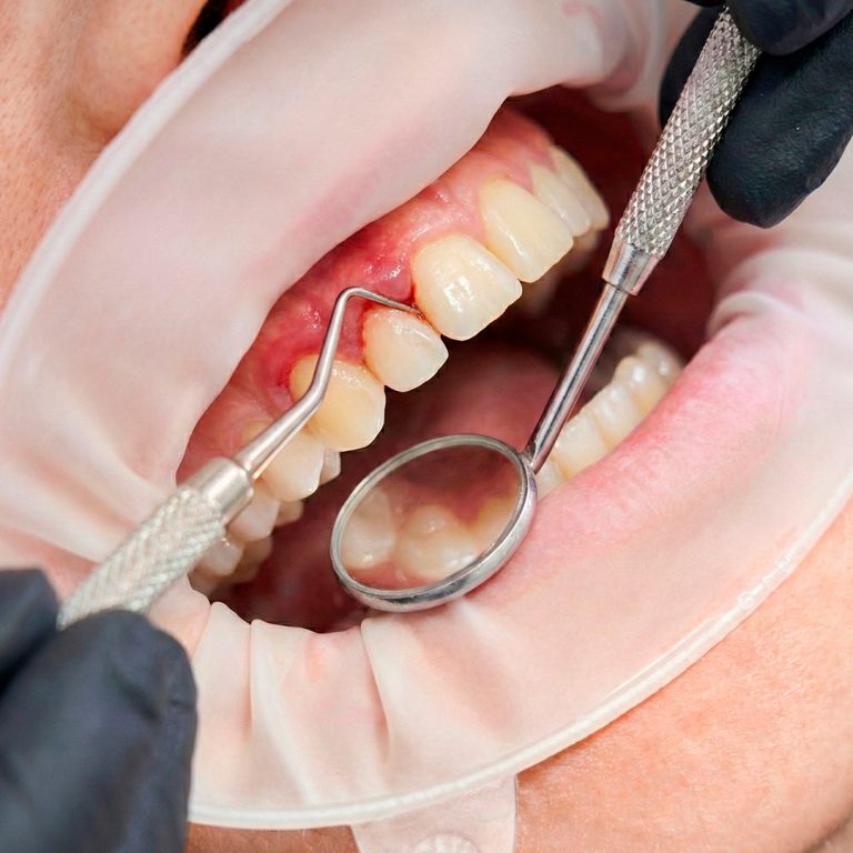 periodoncia